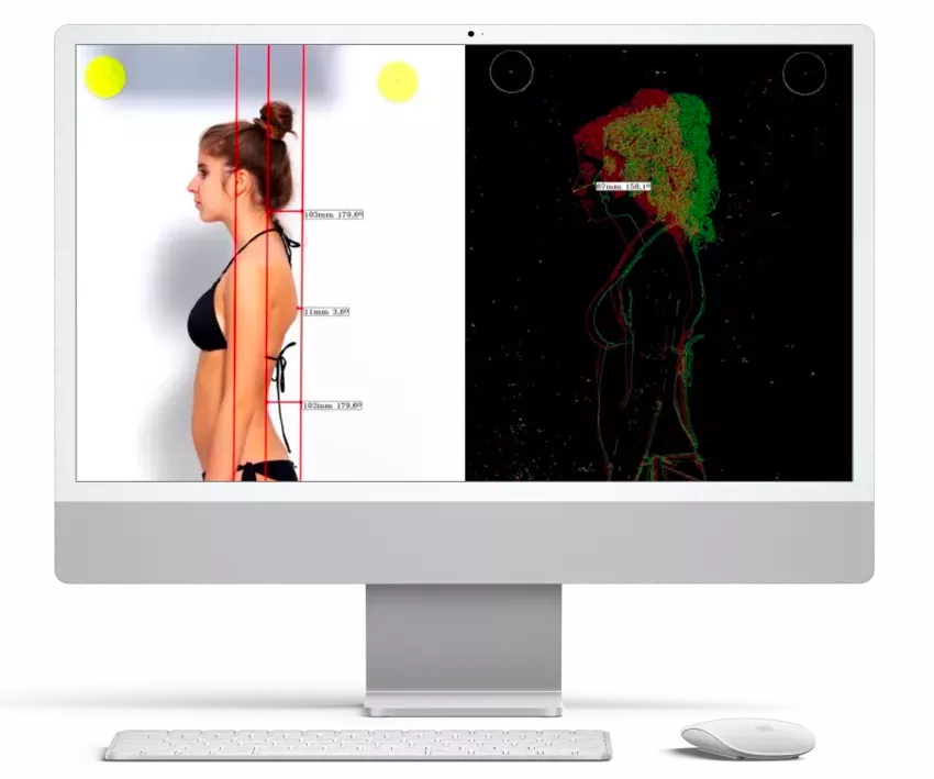 metodo computerizzato per valutazione posturale del dr Puccioni Andrea osteopata di Fucecchio